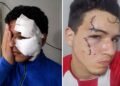 Tafí Viejo: delincuentes con tobillera apuñalaron a un joven